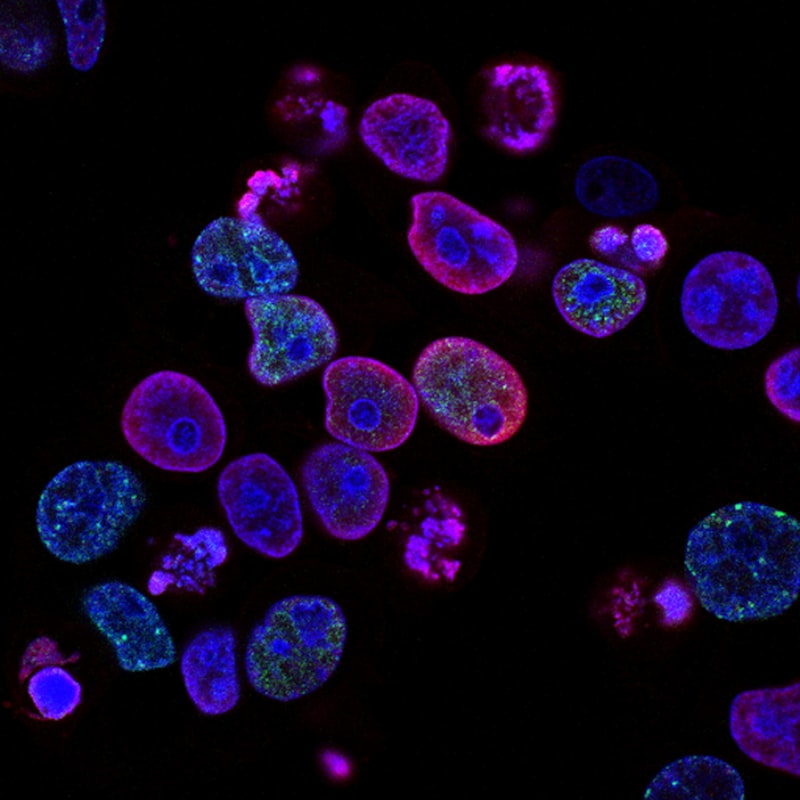 Fluorescence microscopy of parasite-infected cells